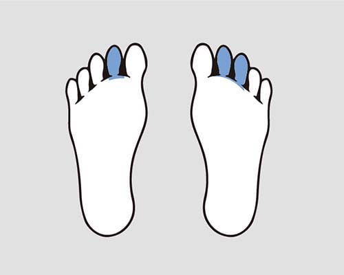足の第二の足指の用を廃したもの、第二の足指を含み二の足指の用を廃したもの又は第三の足指以下の三の足指の用を廃したもの